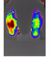 Foot Blood Flow Stimulation Image