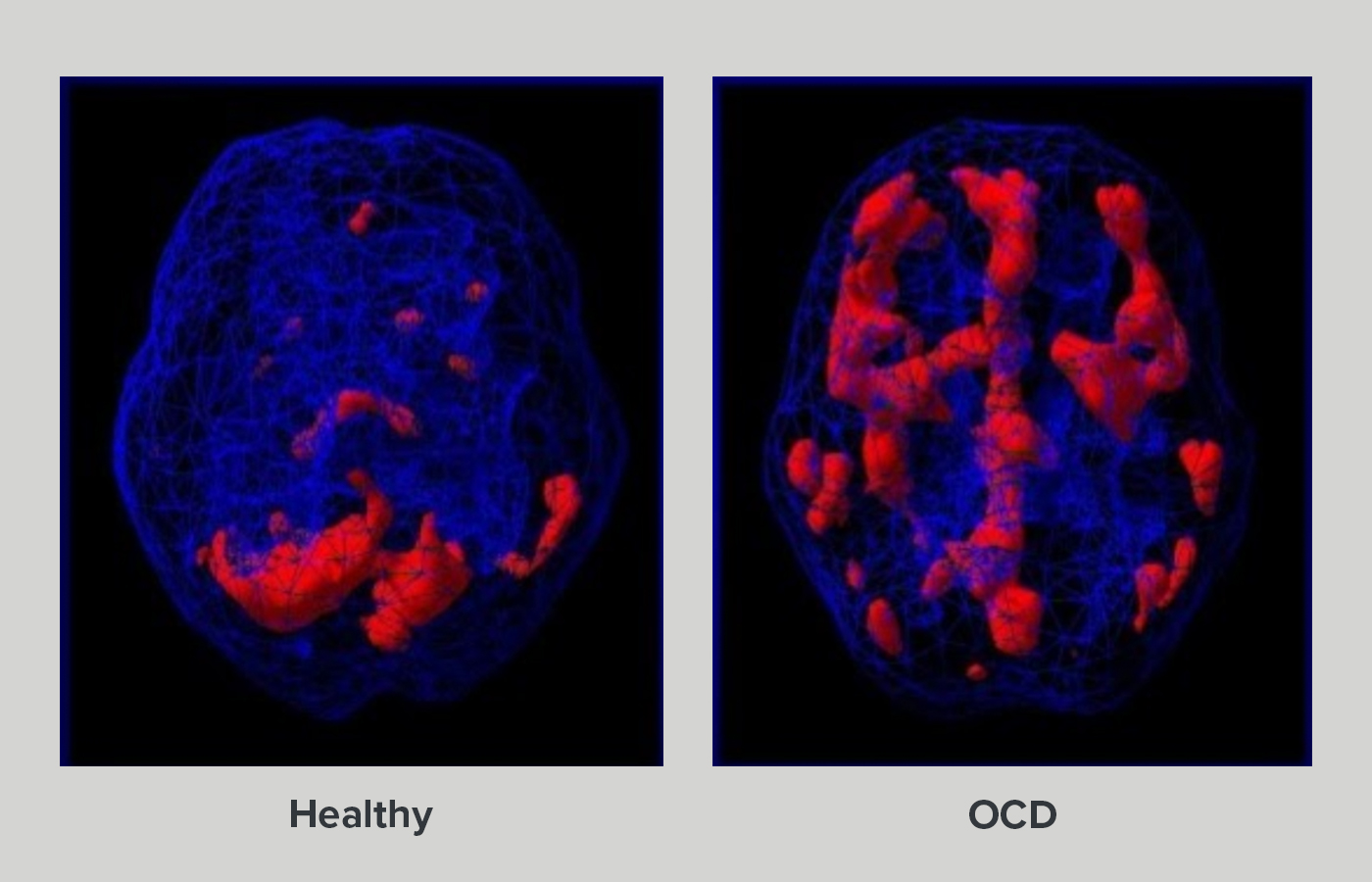 ocd-theramind-center-of-santa-barbara